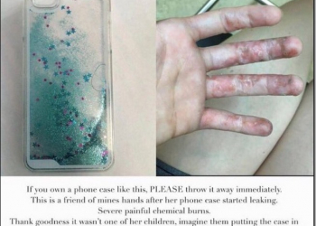 沒事不要用　液體流沙手機殼國外傳出灼傷案例 - 電腦王阿達