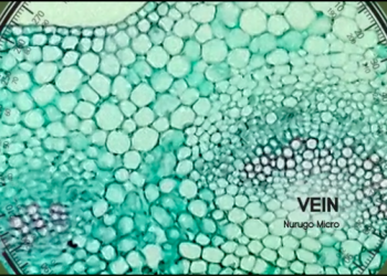 不再是實驗室專利！只要有 Nurugo Micro ，手機就是隨身攜帶的顯微鏡 - 電腦王阿達