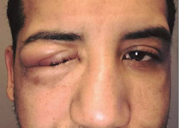 適度就好　國外玩家長時間遊玩VR遊戲造成眼睛腫脹 - 電腦王阿達