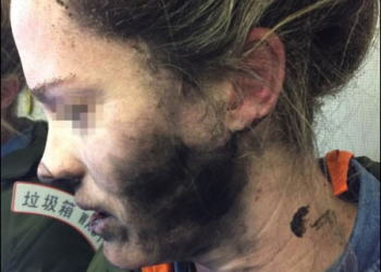 Beats耳機爆炸 的調查報告出爐！ Apple：第三方電池所導致的，拒絕賠償 - 電腦王阿達