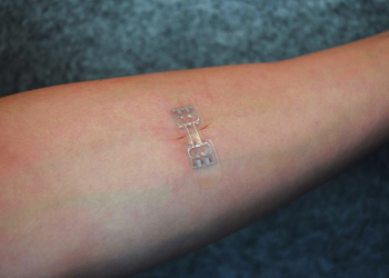 取代縫合針線、恢復更快 microMend 黏在傷口處即會進行癒合 - 電腦王阿達