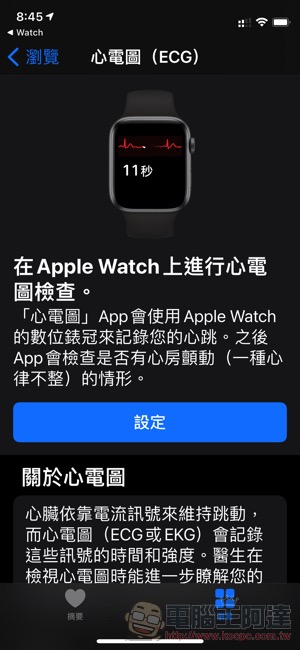 Apple Watch 才在台灣開放 ECG 心電圖功能，就有醫師分享幫病患找出心臟問題的實例 - 電腦王阿達
