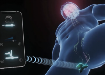 早洩男士的救星！只要貼上這款防早洩穿戴型 OK 繃貼片，就能幫你延遲發射 - 電腦王阿達