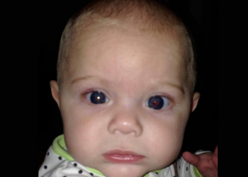 國外媽媽用 iPhone 閃光燈幫自己兒子拍照時，意外發現他罹患罕見癌症 - 電腦王阿達