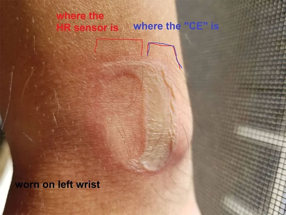 Fitbit 遭提起集體訴訟，旗下多款智慧手錶都有使人燙傷的風險 - 電腦王阿達