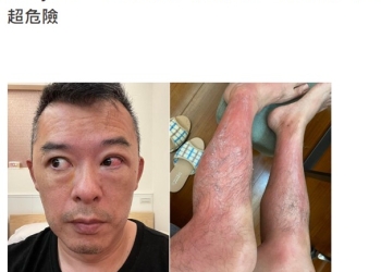 紫外線殺菌燈抽測結果與安全使用注意事項