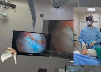 Apple Vision Pro 再度登上手術檯！巴西醫生用它進行肩關節鏡手術